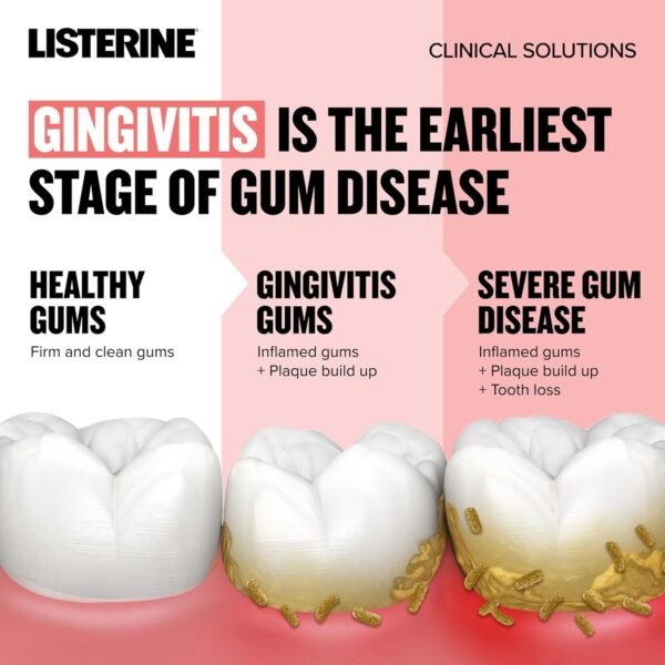 Does Listerine Clinical Solutions Mouthwash Really Prevent Gum Disease Review Worth Reading Does Listerine Clinical Solutions Mouthwash Really Prevent Gum Disease Review Worth Reading