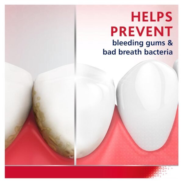 Does Parodontax Mouthwash Really Improve Gum Health Discover Our Detailed Review Does Parodontax Mouthwash Really Improve Gum Health Discover Our Detailed Review