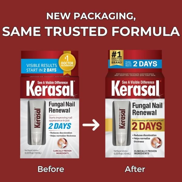 Kerasal Nail Renewal, Restores Appearance of Discolored or Damaged Nails, 0.33 fl oz (Packaging May Vary) Kerasal Nail Renewal, Restores Appearance of Discolored or Damaged Nails, 0.33 fl oz (Packaging May Vary)